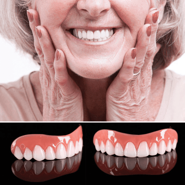 Perfect Smile Veneers